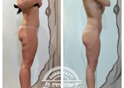 Prima e Dopo BootyUp di Laura Cavarischia - Metodo per il modellamento corpo - Centro La Creazione Tolentino - Modellamento Corpo